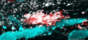 Dynamic tracking of Fth1 expresssion in phagocytes